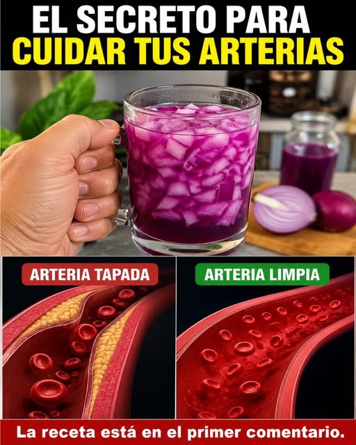 Cebolla Morada y Salud de las Arterias