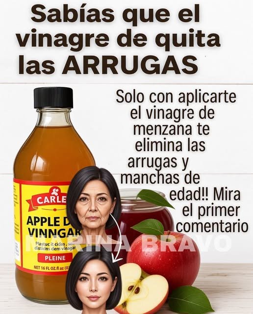 Beneficios del vinagre de manzana