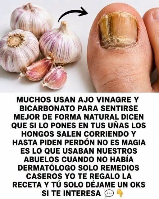 Tratamiento natural para hongos en las uñas