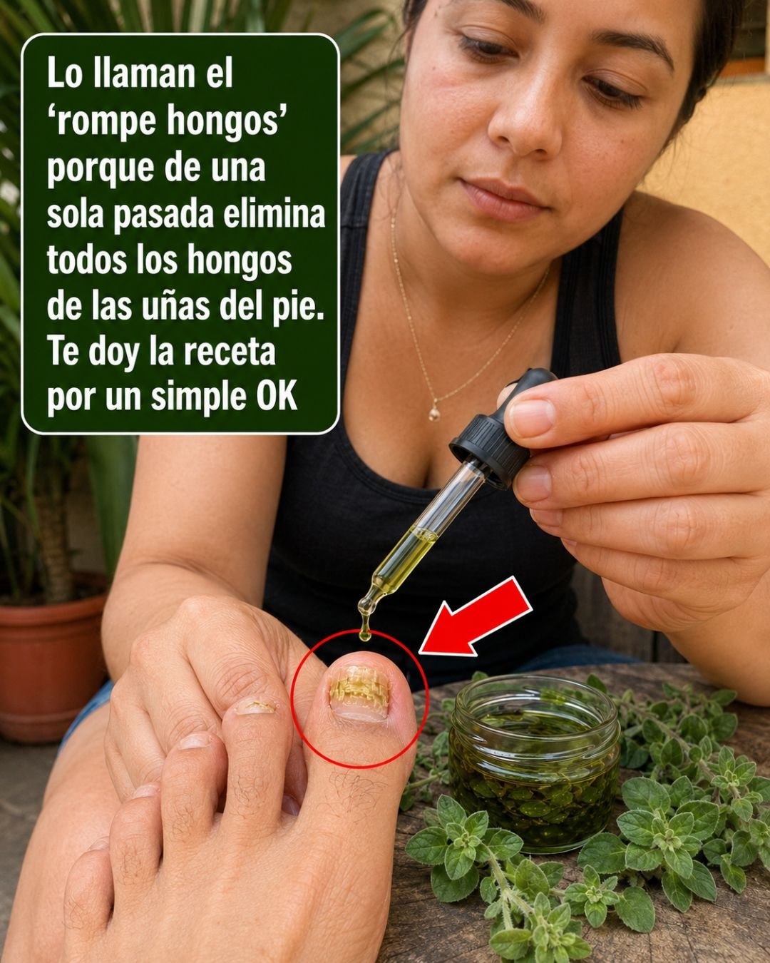 Aplicación de aceite de orégano en las uñas del pie