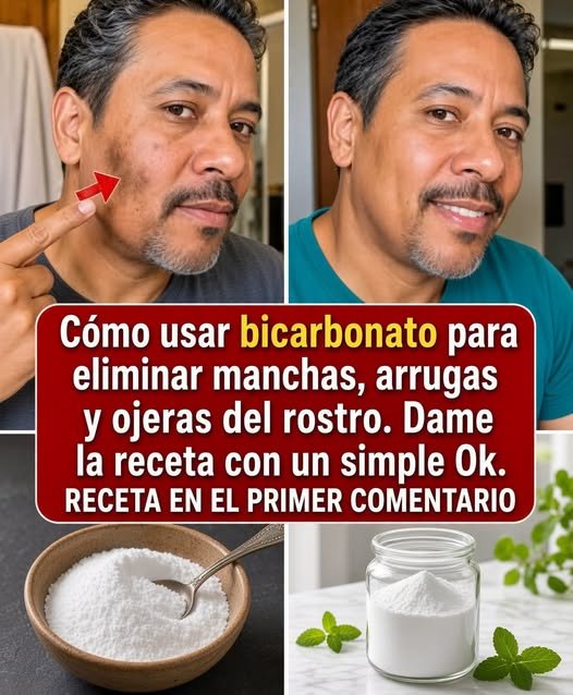 Bicarbonato de sodio en el rostro