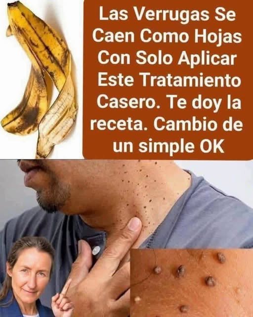Cáscaras de plátano