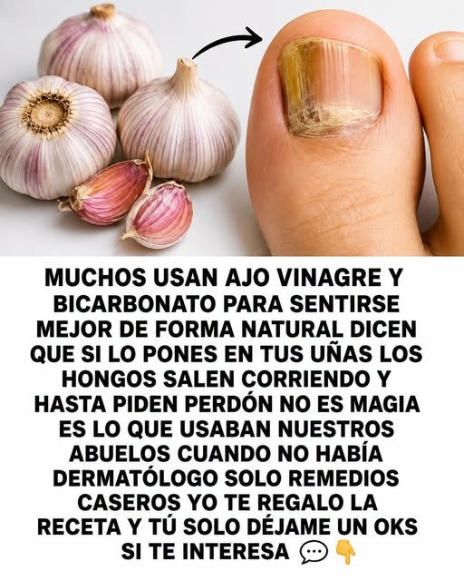Ajo y Uñas Hongosas