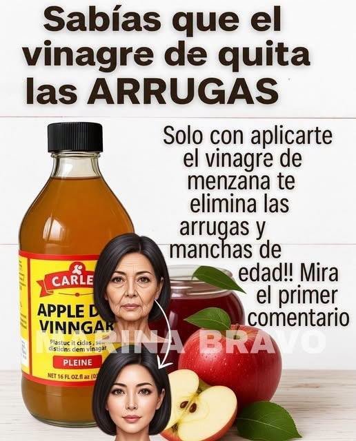 Beneficios del vinagre de manzana