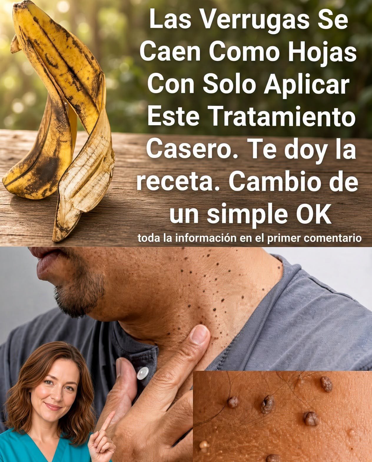 Tratamientos caseros para verrugas