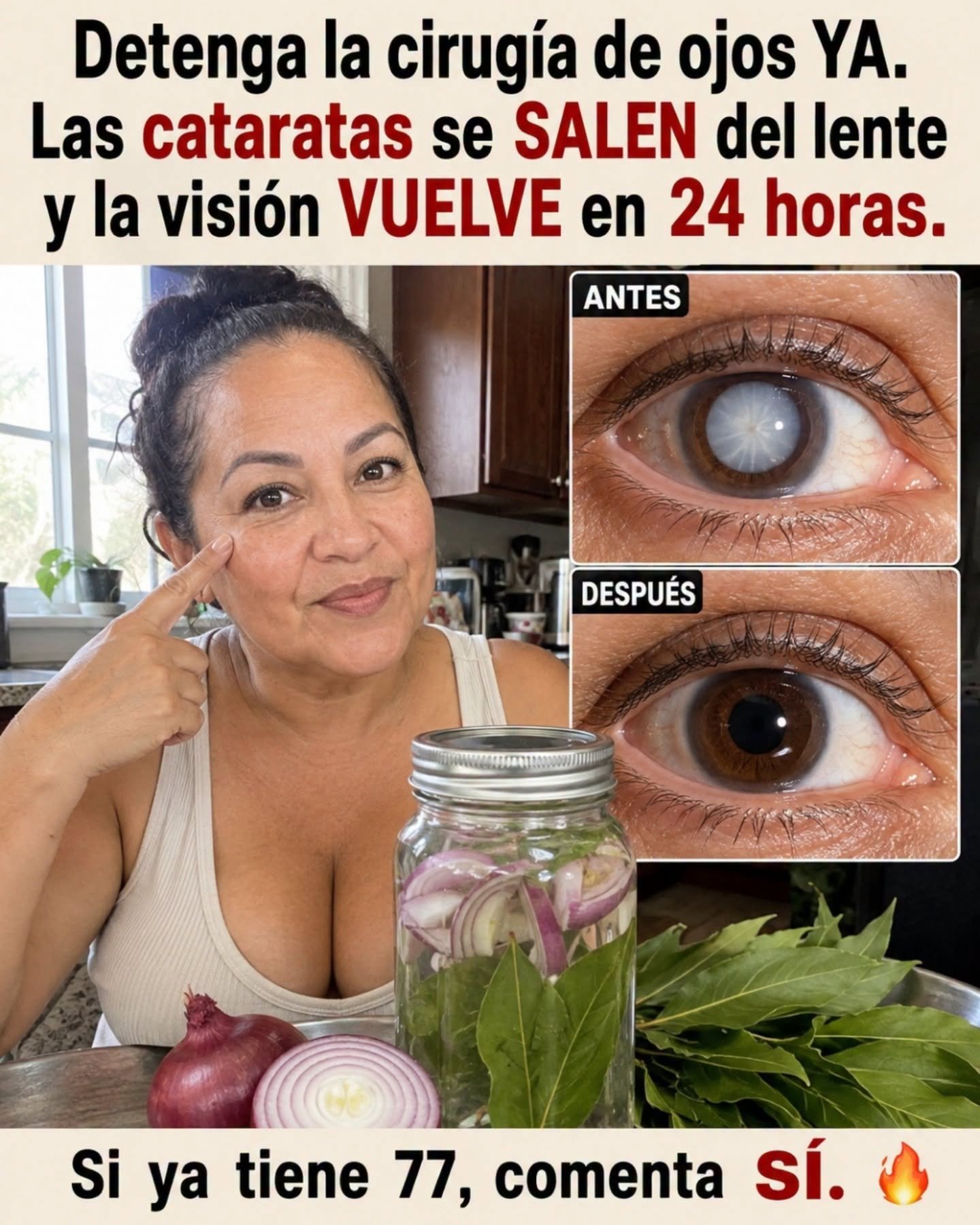 Remedios Naturales para Cataratas