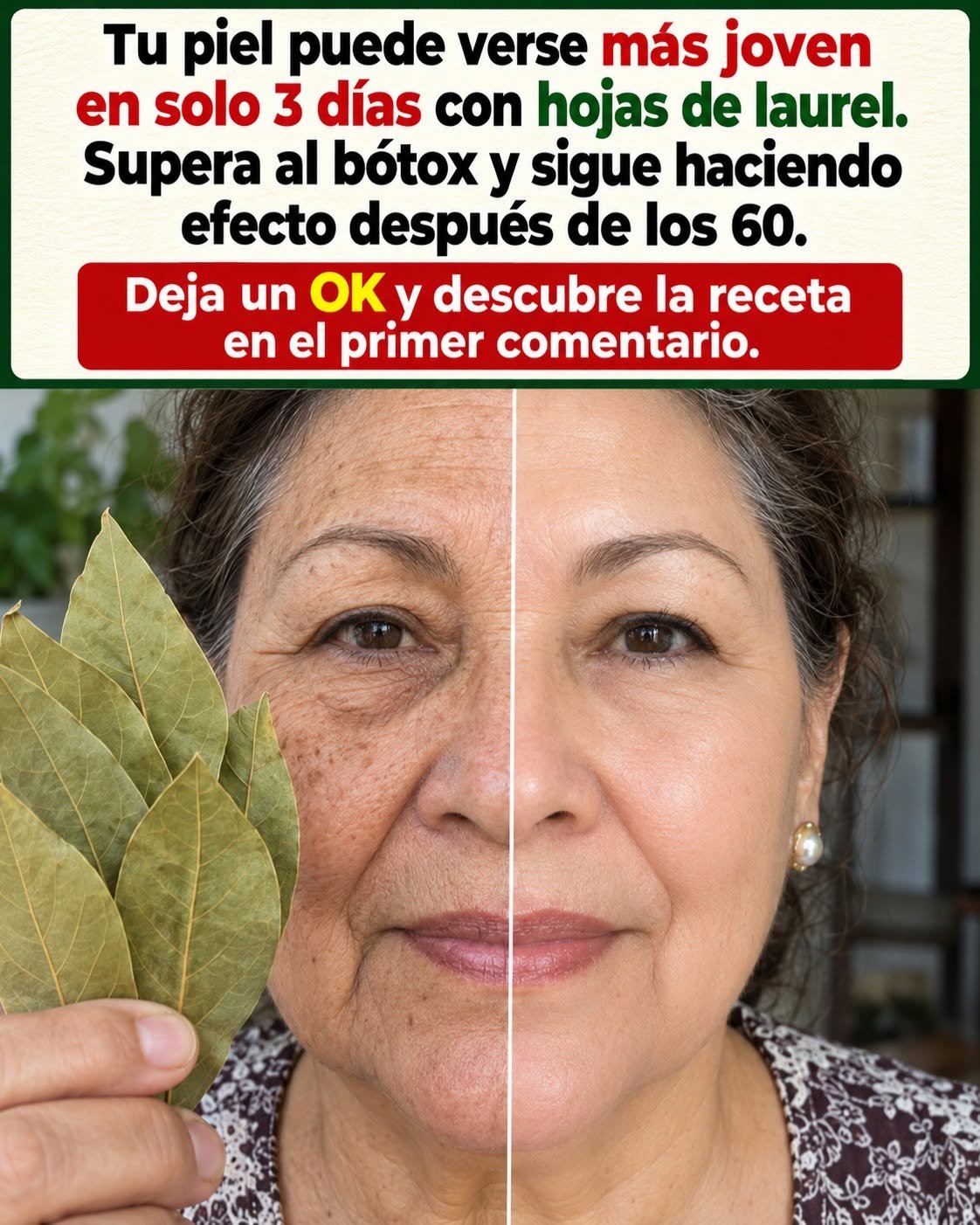 Hojas de Laurel para el Cuidado de la Piel
