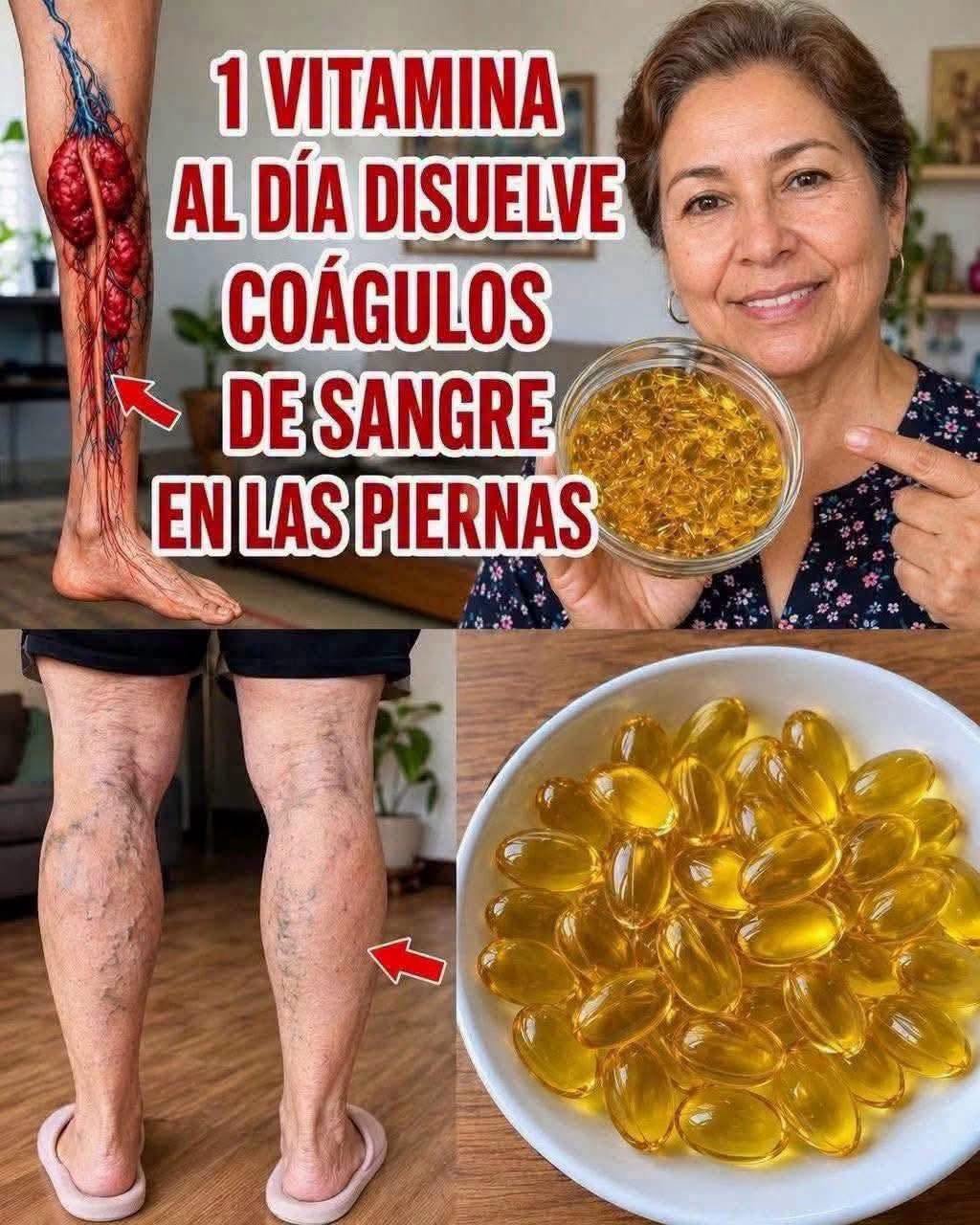 Suplementos de vitamina para la salud venosa