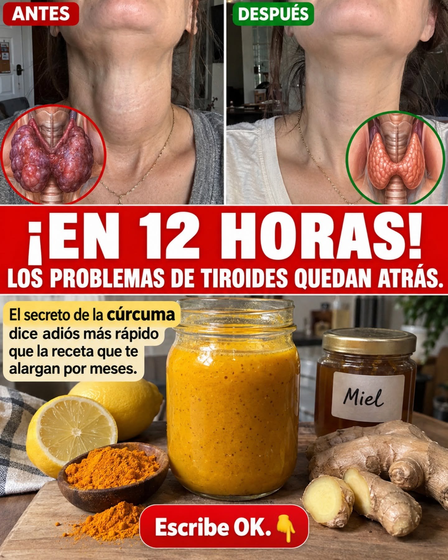 Mejora en la apariencia de la zona del cuello