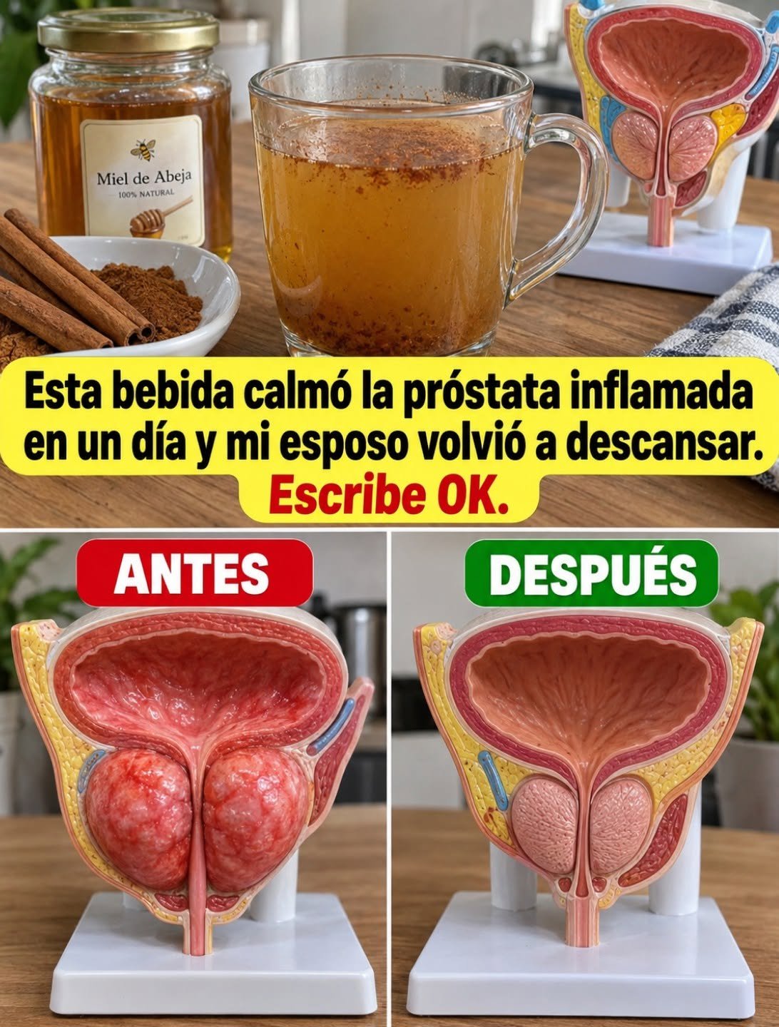 Bebida Natural para la Salud de la Próstata