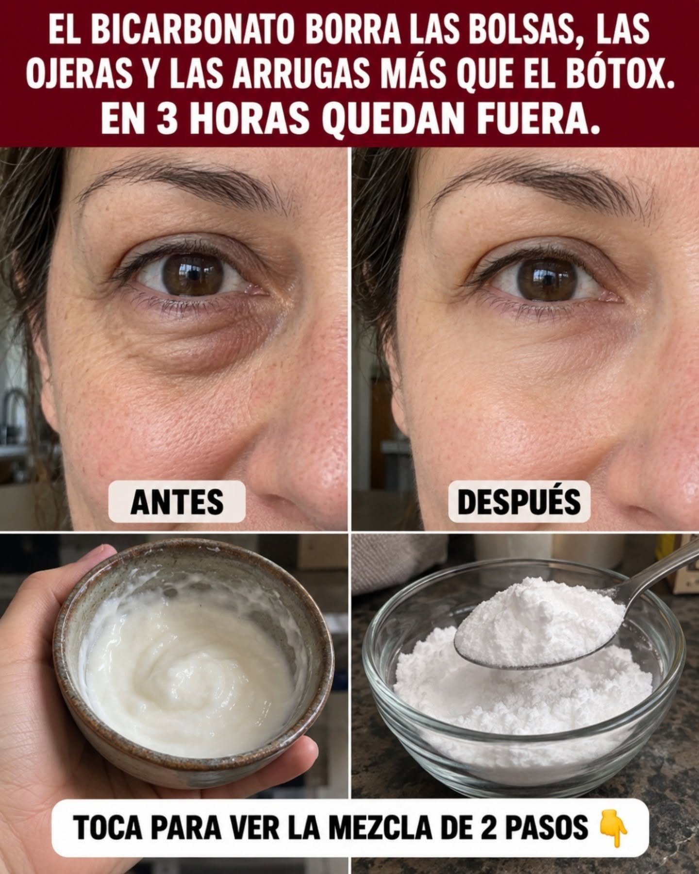 Comparativa antes y después de usar bicarbonato en el contorno de ojos