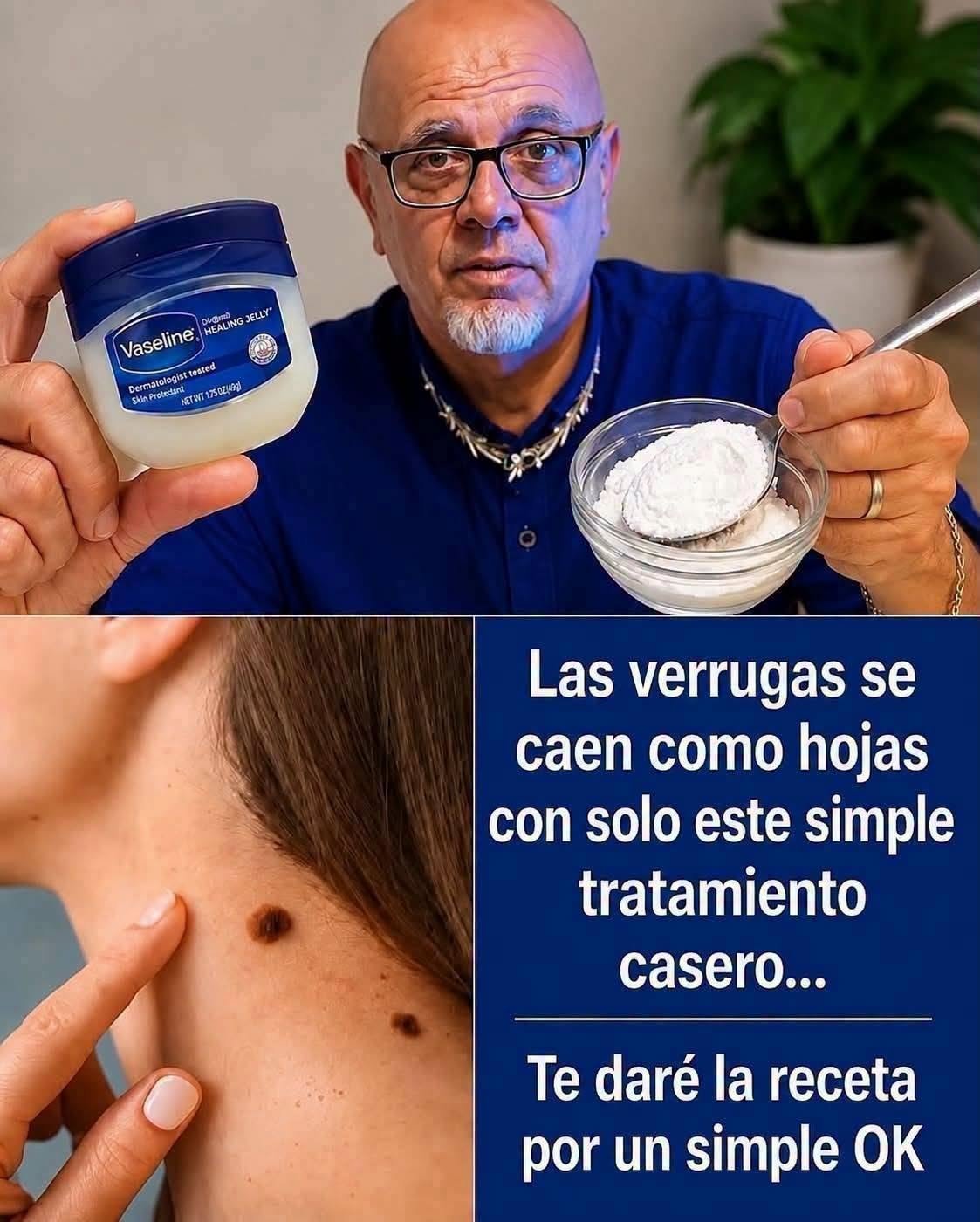 Tratamiento casero para verrugas con vaselina