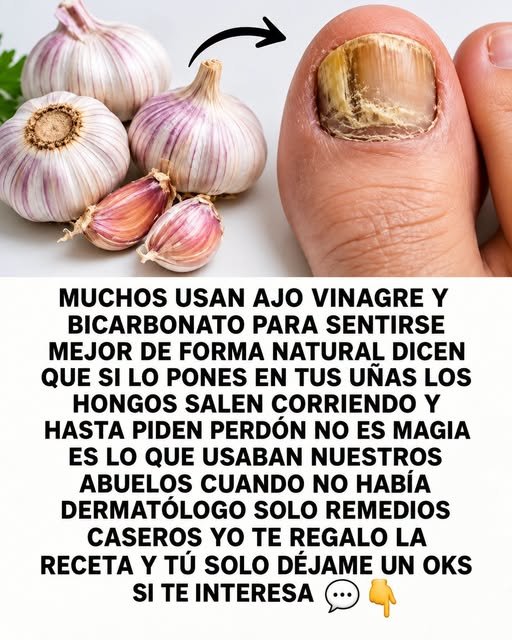 Bulbos de ajo y pie con uña afectada