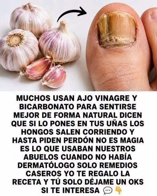Ajo y uña infectada por hongos