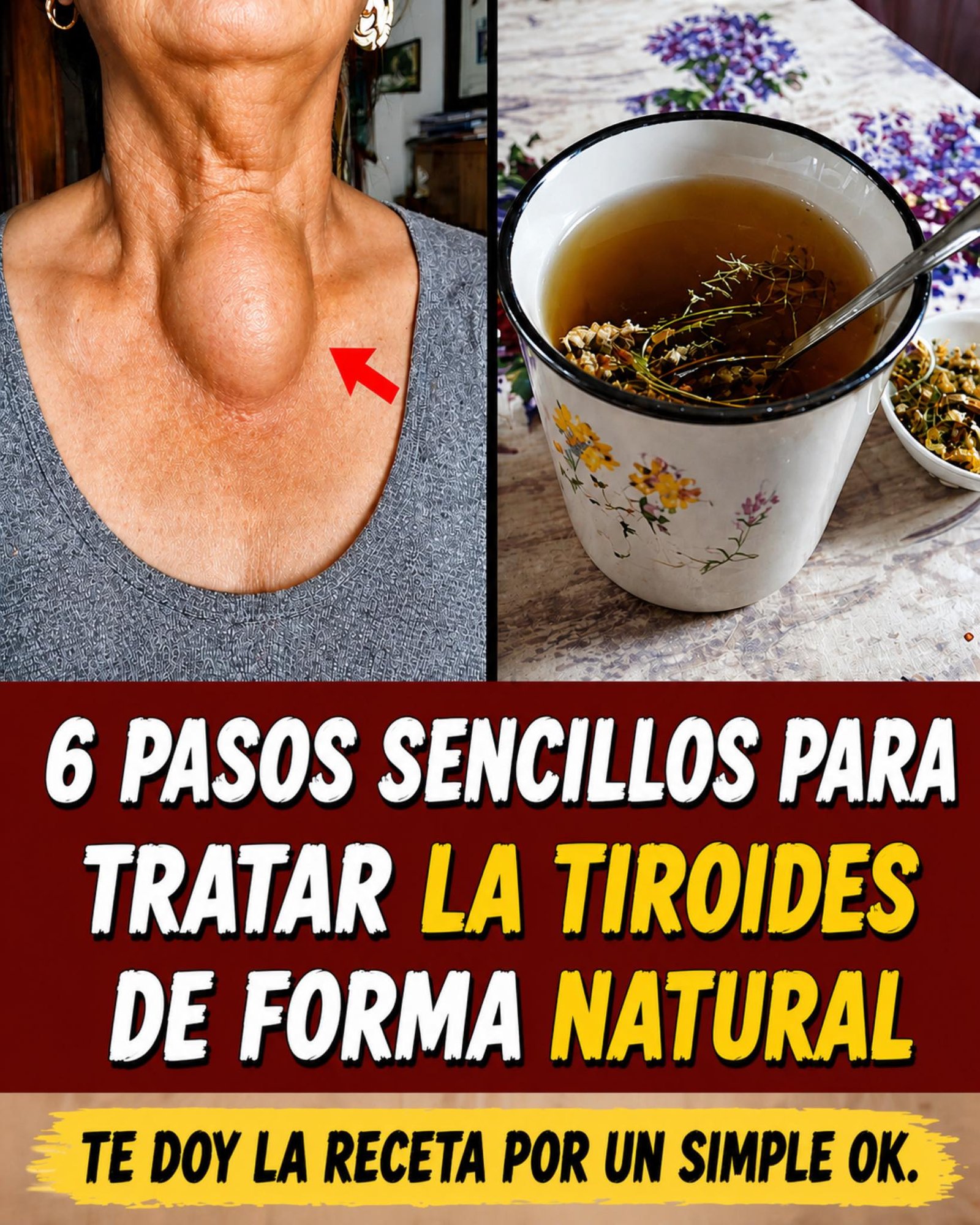 Cuidado de la tiroides de forma natural